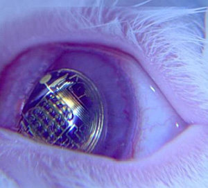 Bionische Kontaktlinse: Erfolgreich an Hasen getestet (Foto: wustl.edu)