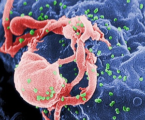 HI-Virus: Spamjäger rücken nun dem Erreger zu Leibe (Foto: Wikimedia)