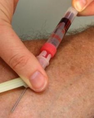 Blutabnahme: Neuer Behandlungsansatz gefunden (Foto: pixelio.de, Rainer Sturm)