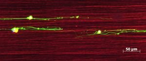 Seidenfäden helfen Nerven bei Regeneration – Hoffnung auf Wiederherstellung von Rückenmark und Sehnerv