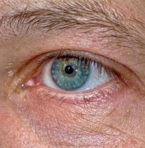 Auge: Behandlung mit Stammzellen umstritten (Foto: pixelio.de, Templermeister)