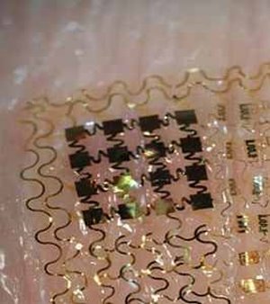 Elektronische Haut soll Untersuchungen erleichtern – Erfindung entkoppelt Patienten von stationären Messgeräten