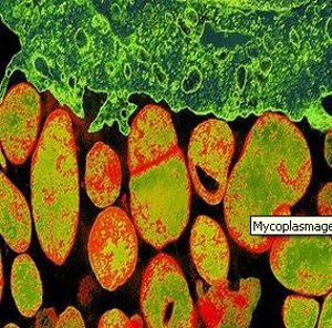 Myxoplasma genitalium: simuliert (Foto: cc microbiologyglossary.wikispaces.com)