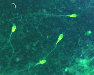Spermazellen: enthalten Eisprung-Signale - doch nur bei Tieren (Foto: Wikimedia)