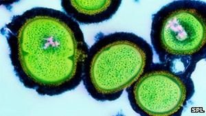Vitamin B3 schaltet MRSA-Krankenhauskeime aus – Neutrophile können schädliche Bakterienstämme besser abwehren