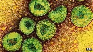 Coronaviren: neuer Virus sorgt für Aufregung (Foto: SPL)