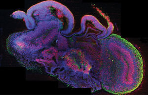Querschnitt eines vollständigen cerebralen Organoids (Foto: de.imba.oeaw.ac.at)