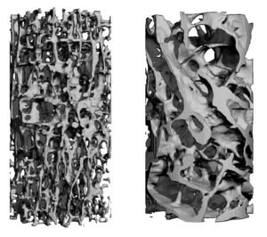 Knochen-CT: Forscher wollen Struktur verstehen (Foto: flickr.com, organprinter)