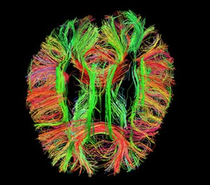 3D-Modell: das lebende menschliche Gehirn (Foto: humanconnectomeproject.org)
