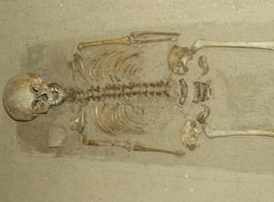 Down-Syndrom: Bisher ältester Fall gefunden Kind wurde vor 1.500 Jahren in Frankreich begraben