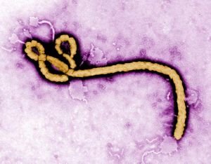 DNA-Computer erkennt tödliche Viren wie Ebola – Einfachere Diagnose soll helfen, Ausbreitung frühzeitig einzudämmen