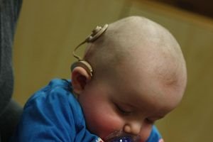 Hörgeschädigte Babys brabbeln weniger