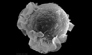Krebserregendes Virus blockiert Immunreaktion – Neue Erklärung für unterschiedliche Behandlungserfolge gefunden