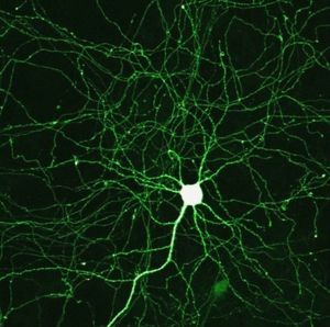 Künstliche Zelle verbessert Computernetzwerke – Neues Neuron ist besser, schneller und energieeffizienter als Vorgänger